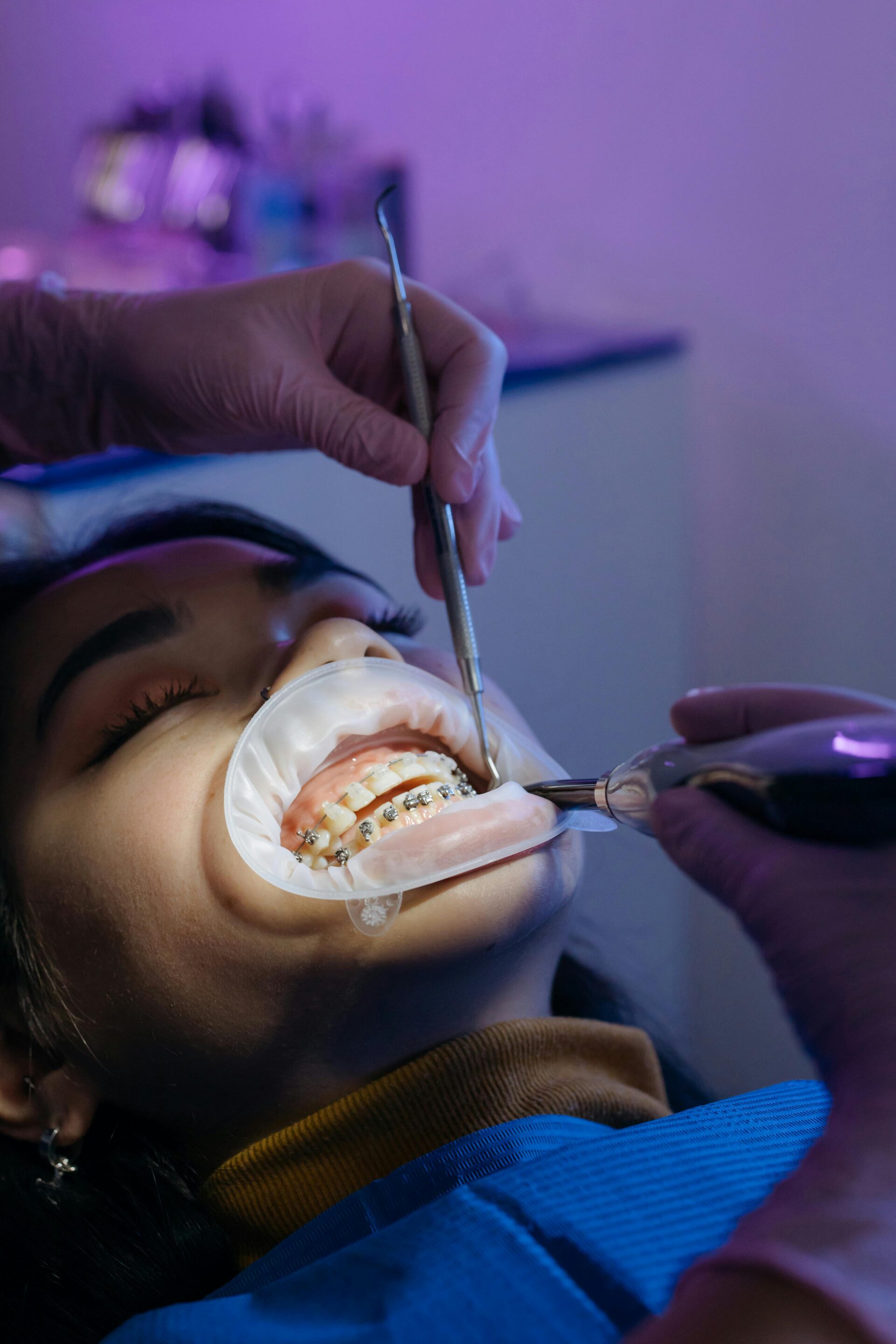 Types of Braces: Metal, Ceramic, Lingual, and Self-Ligating