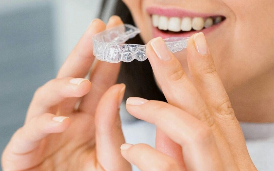 Overbite Treatment: Braces, Aligners, or Surgery?