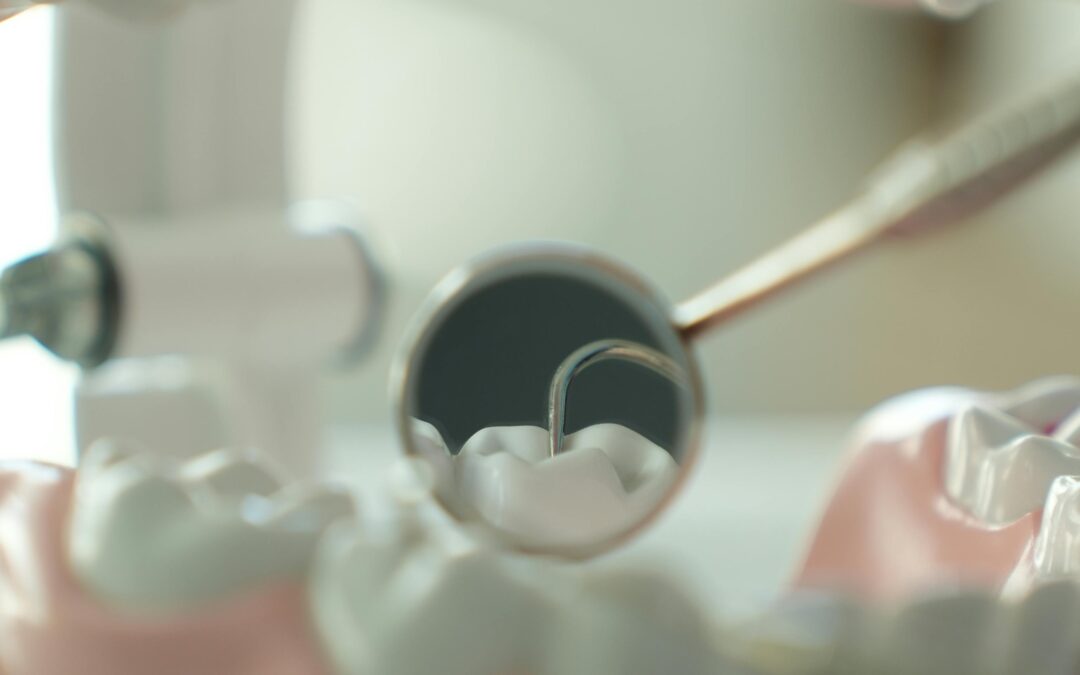 Why Do Root Canals Become Infected?