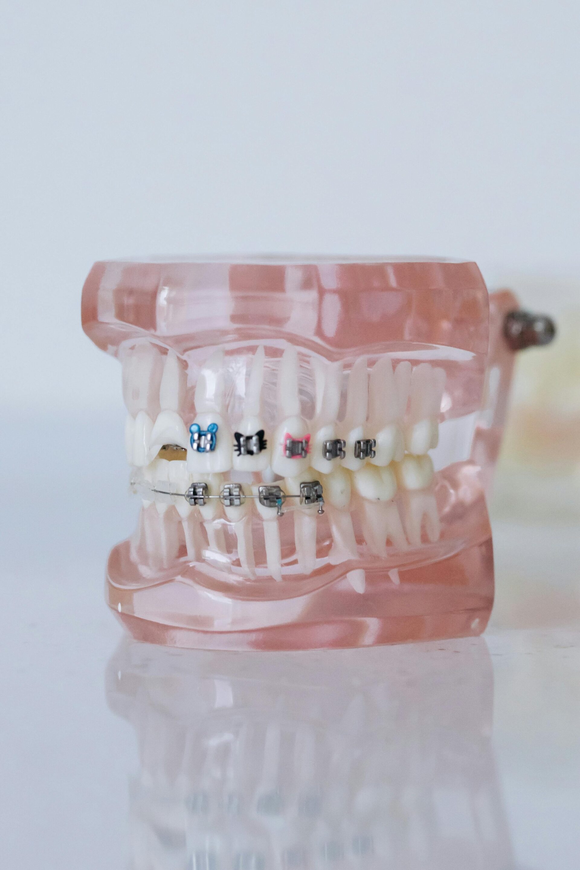 Can Invisalign Fix My Bite?