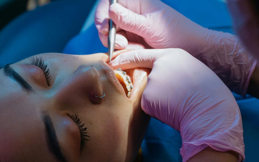 Local Anesthesia for Oral Surgery