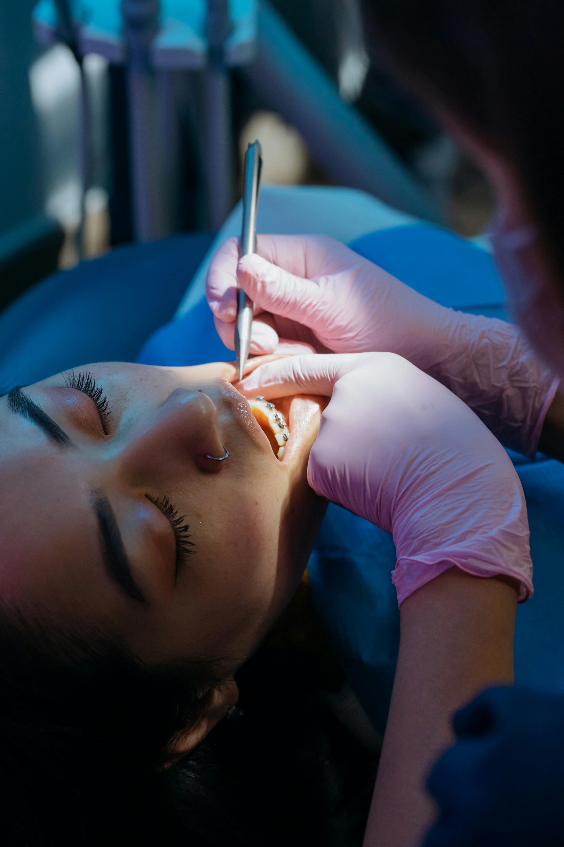 Local Anesthesia for Oral Surgery