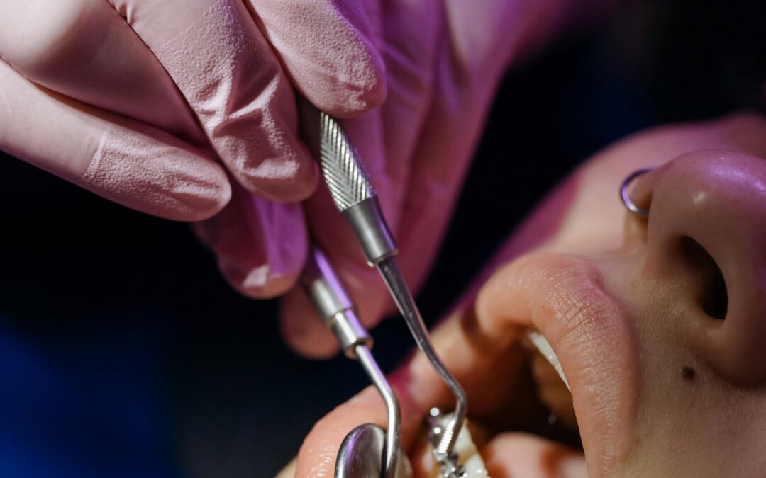 What Bite Problems Can Only Braces Fix?