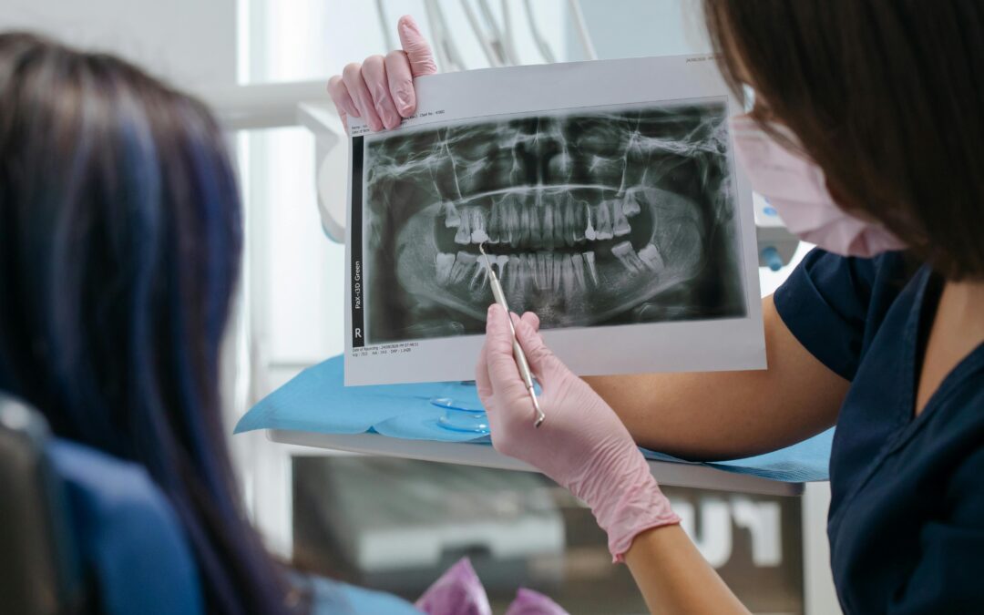 What Happens to Your Jaw When You Lose a Tooth?