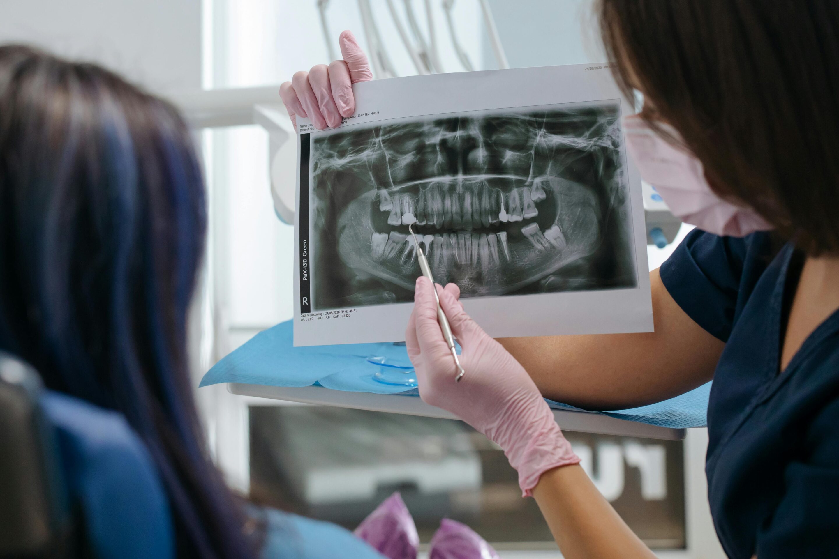 What Happens to Your Jaw When You Lose a Tooth? dental implants featured image