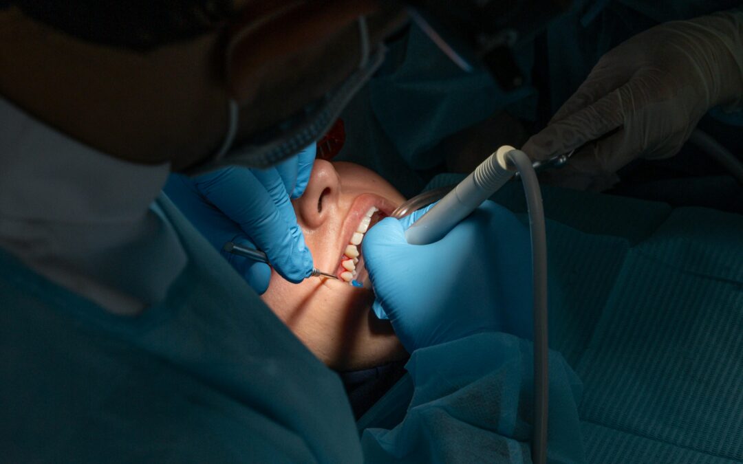 What to Eat Before Oral Surgery