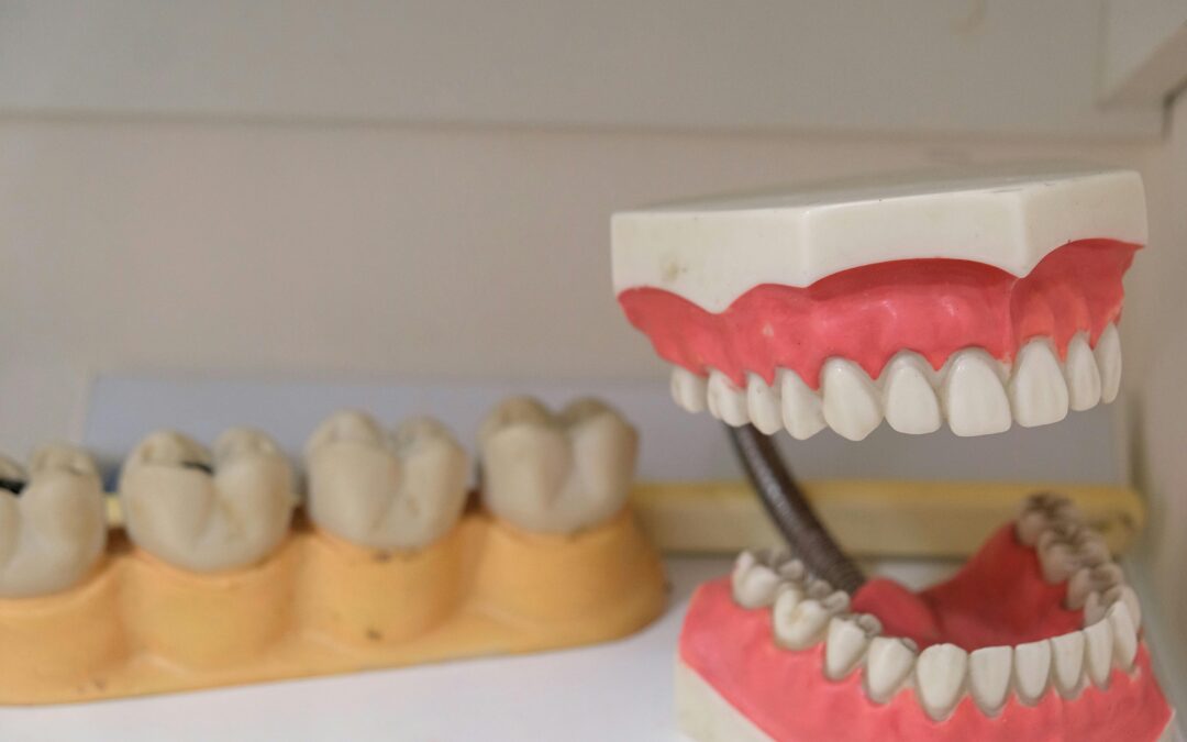 Titanium vs Zirconia Implants: Which Is Better?