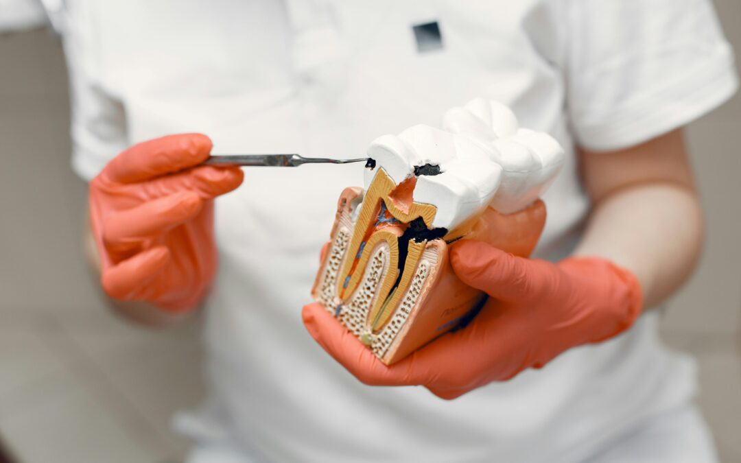 What Happens Inside the Tooth During a Root Canal?