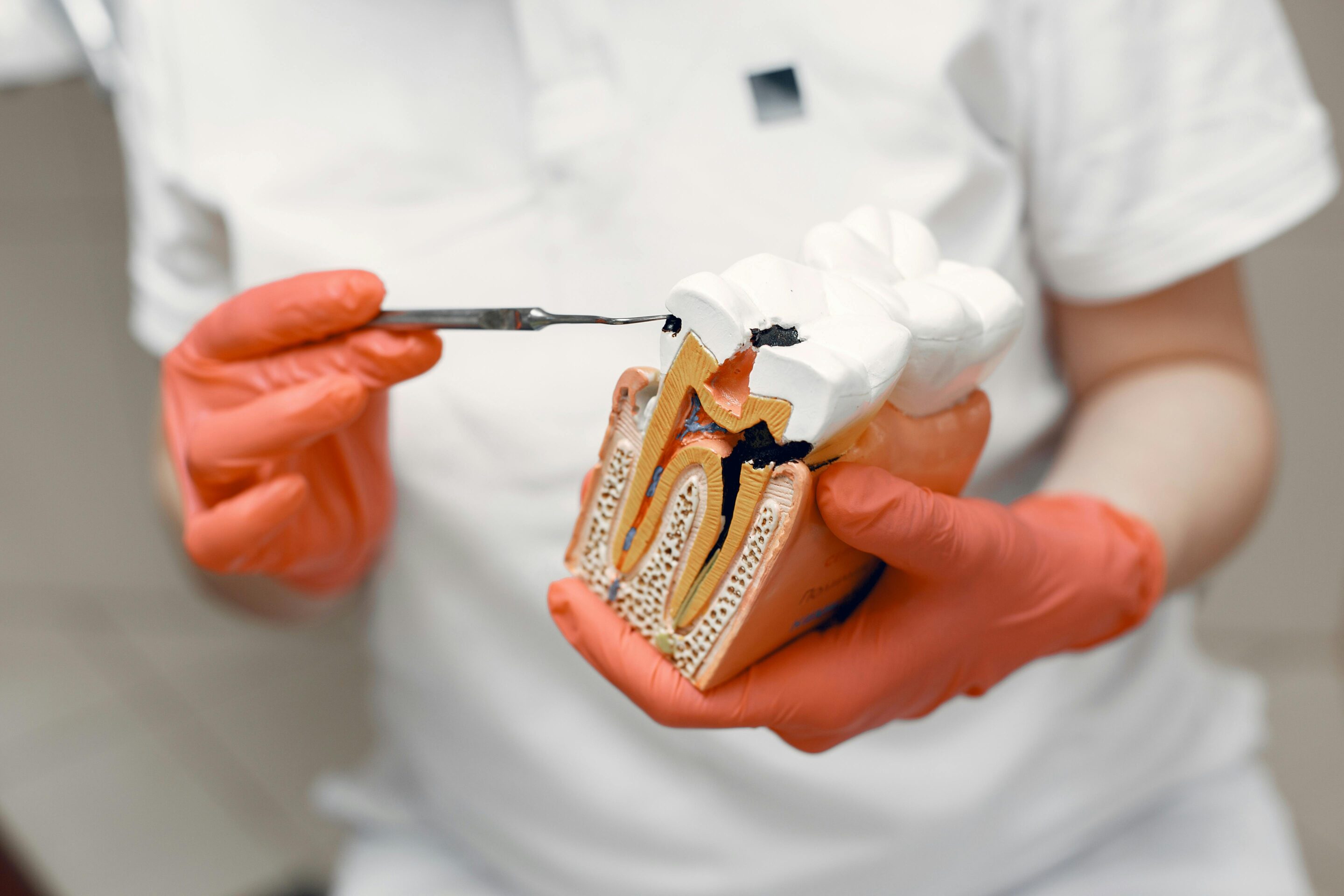 Tooth anatomy model explaining root canal treatment