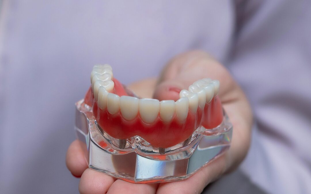 Dental Implant Success Rate: What the Research Shows