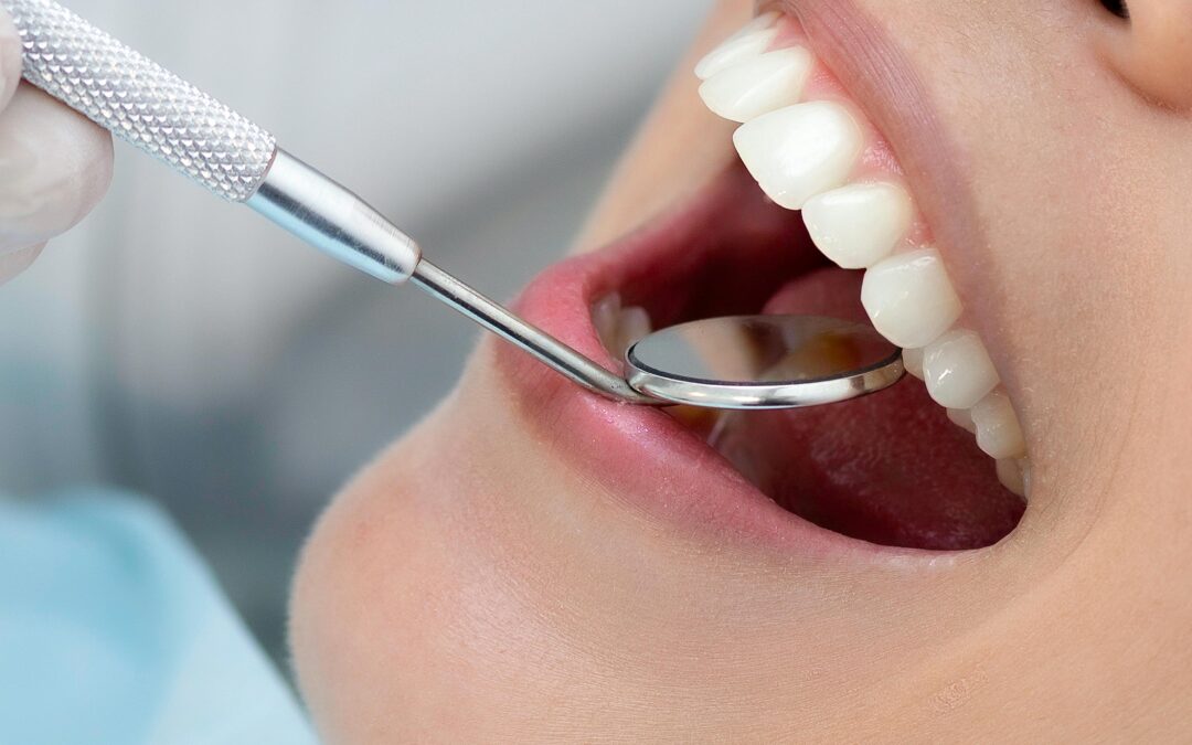 Stage 4 Periodontal Disease: What to Know