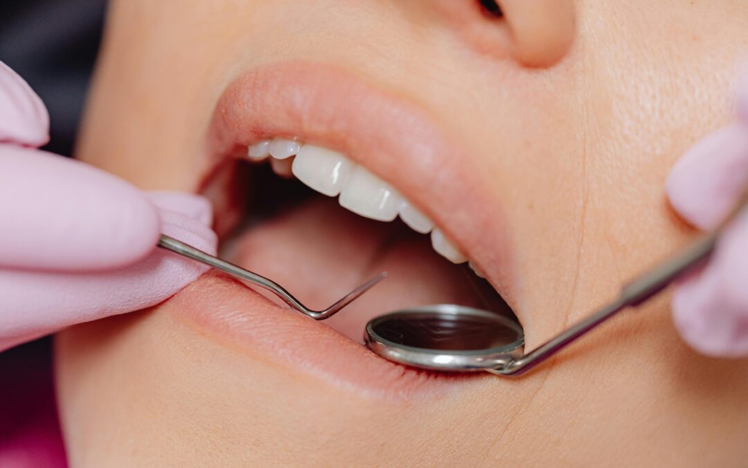 Stage 3 Periodontal Disease: What to Know