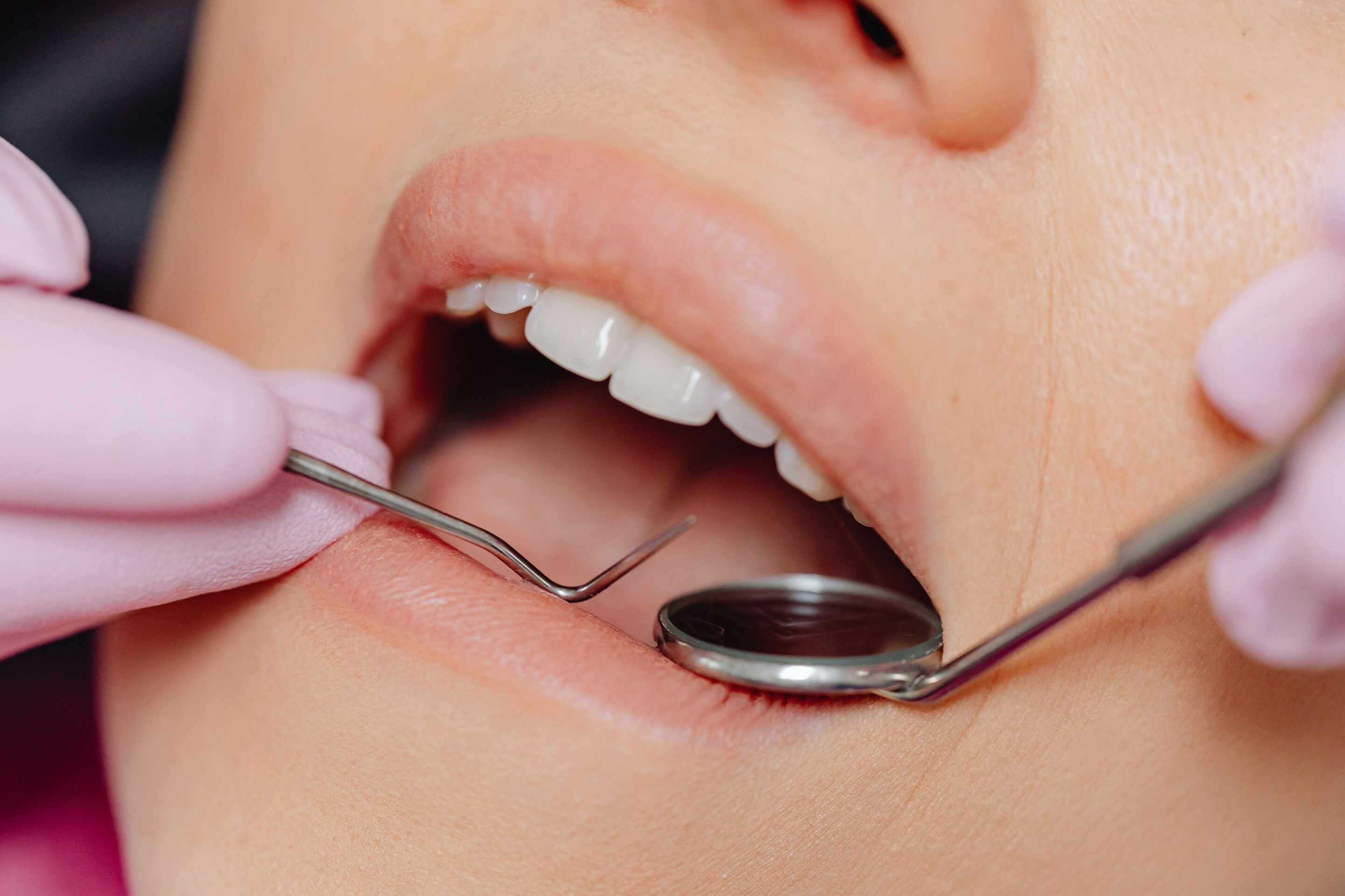 Open mouth examination during dental visit