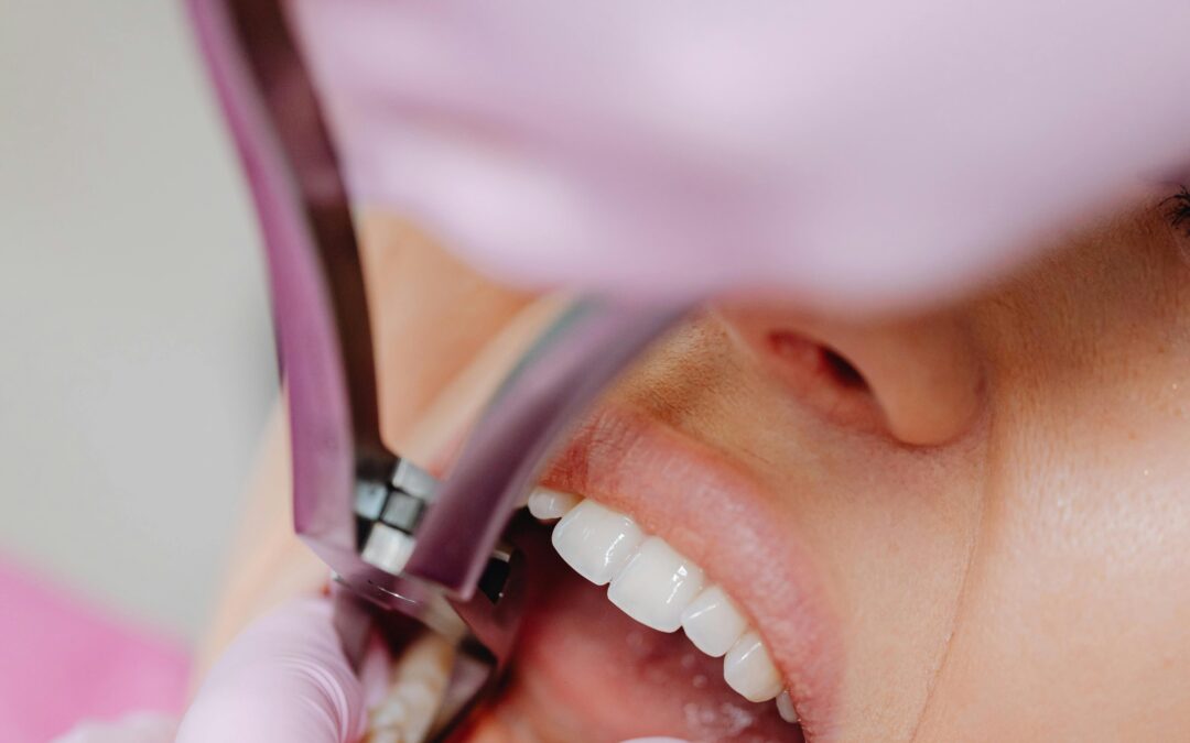 How to Floss Correctly ‚Äî Most People Do It Wrong