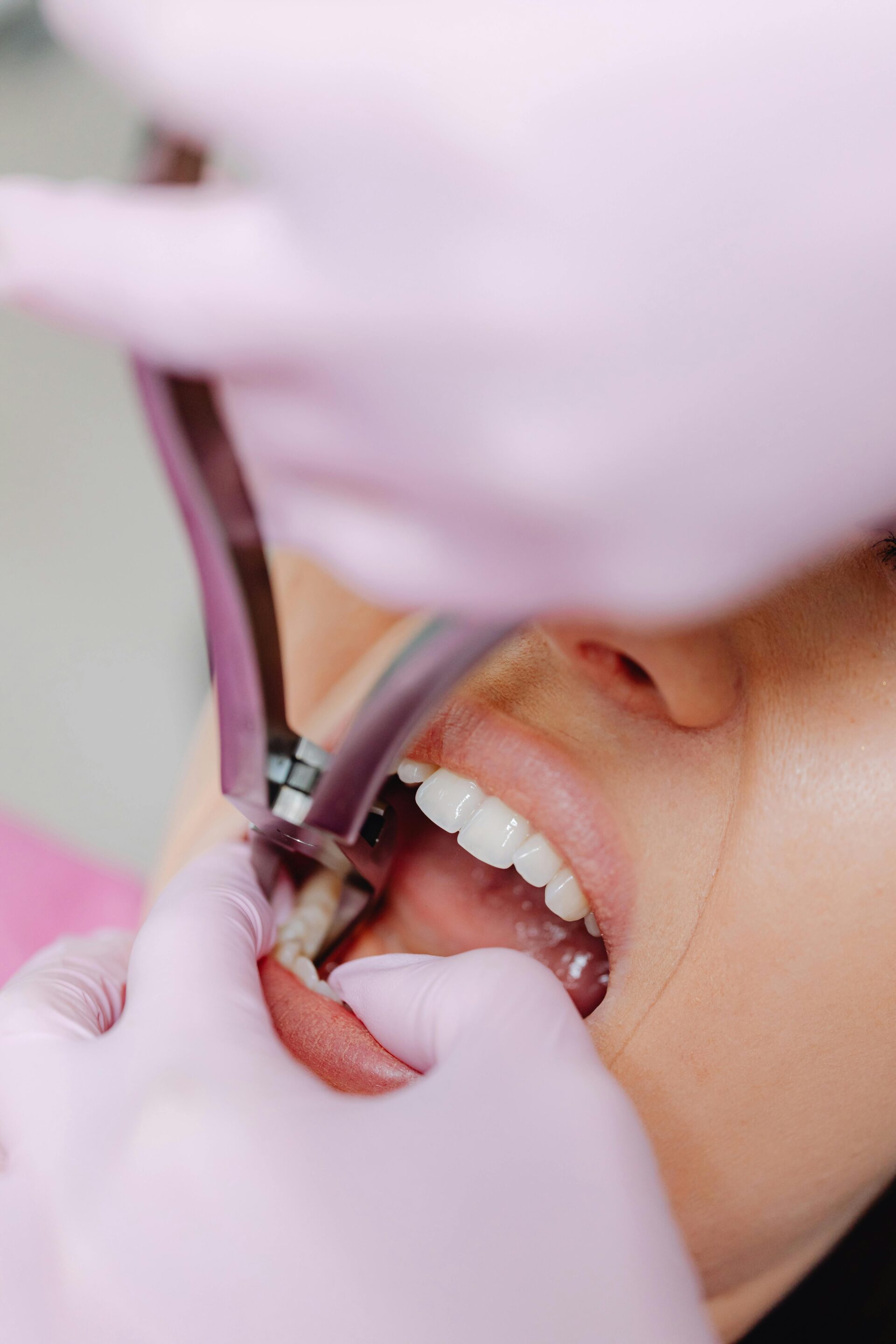 How to Floss Correctly ‚Äî Most People Do It Wrong