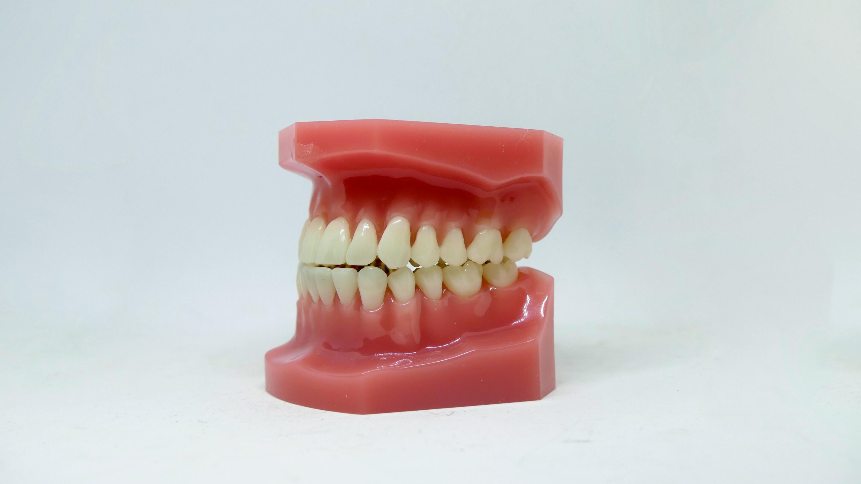 Dental model showing teeth and gums
