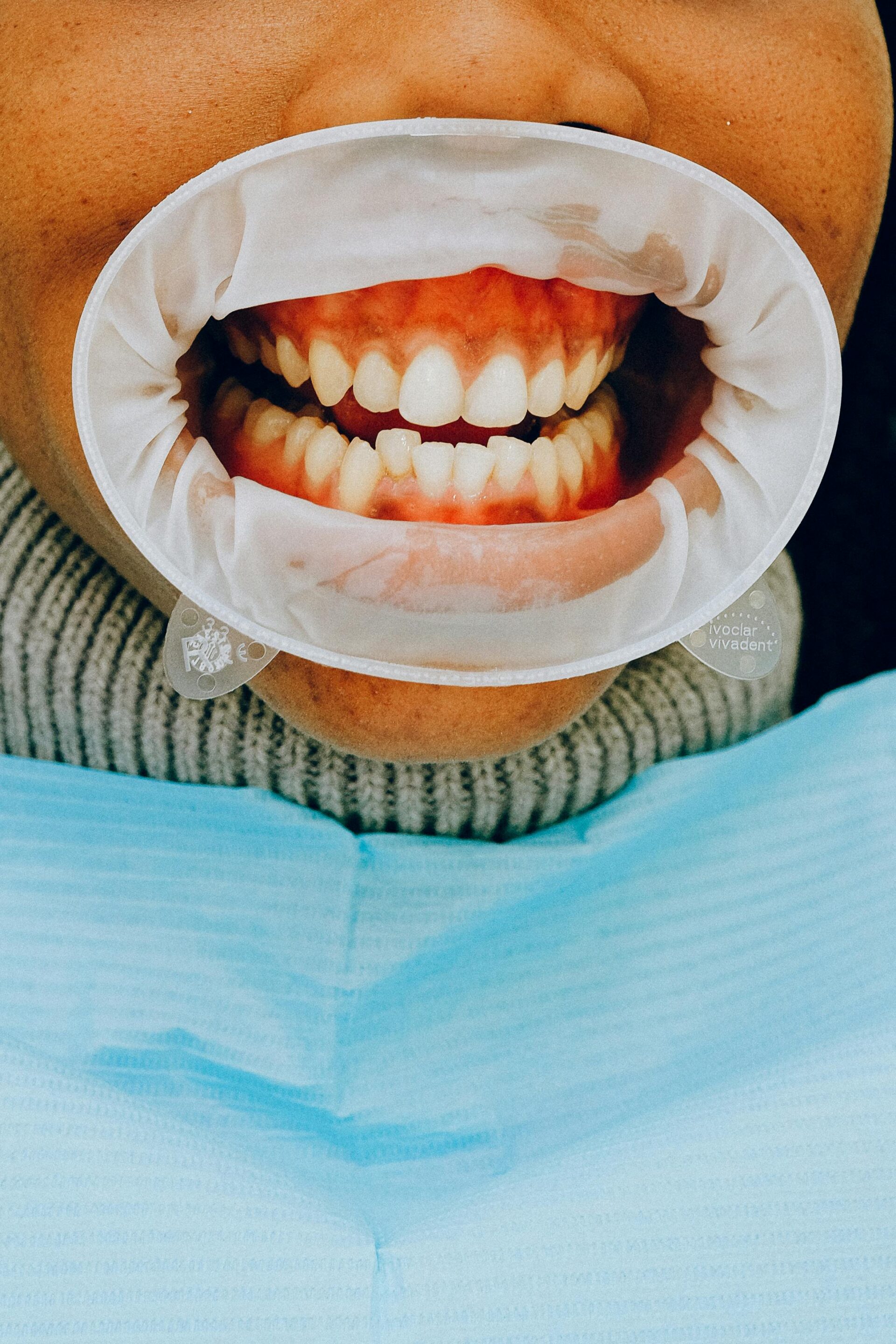 Open mouth view showing gums during dental checkup