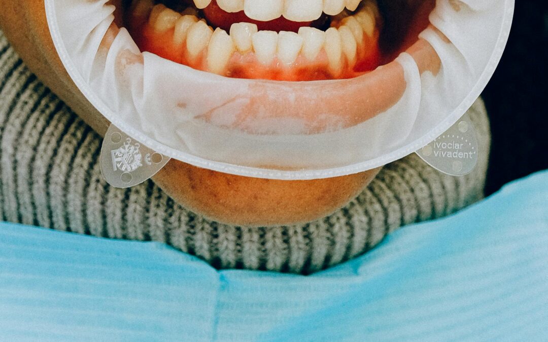 Stage 2 Periodontal Disease: What to Know