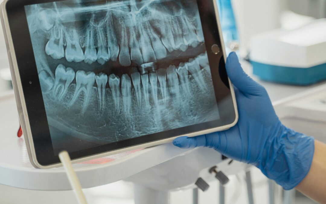 Dental Abscess: Signs, Symptoms, and What to Do