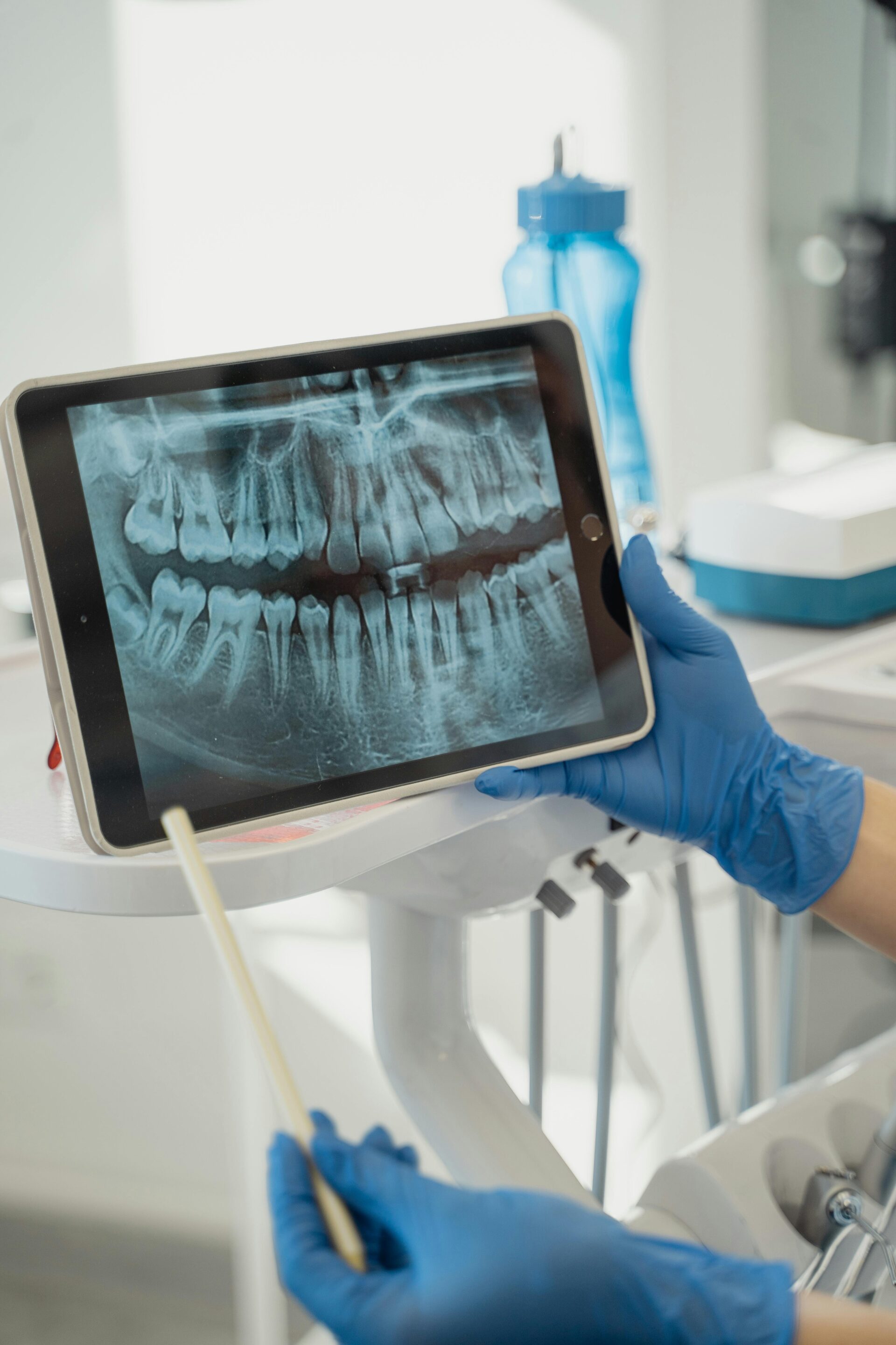 Dental x-ray displayed on a tablet