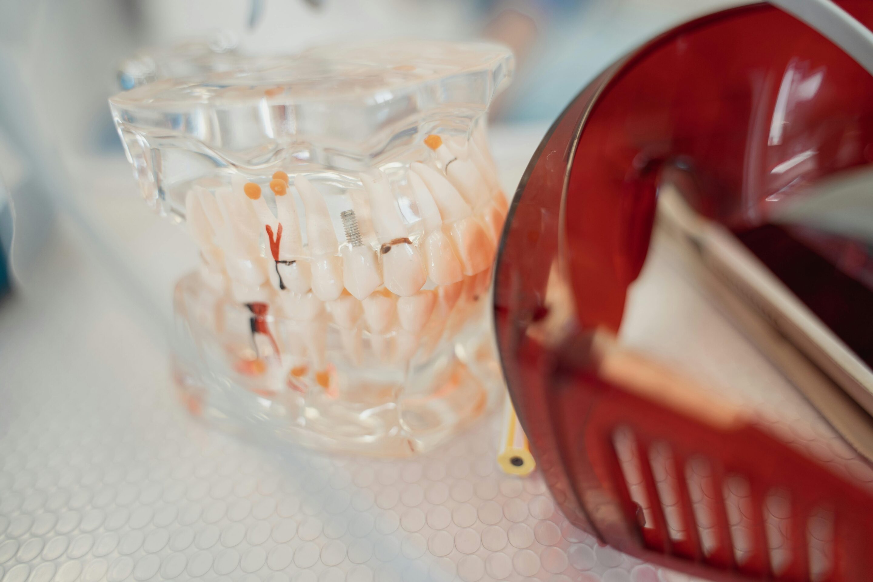 Why Implants Are Considered the Gold Standard for Tooth Replacement dental implants featured image
