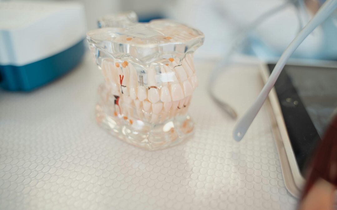 What Is Plaque and How Do You Get Rid of It?