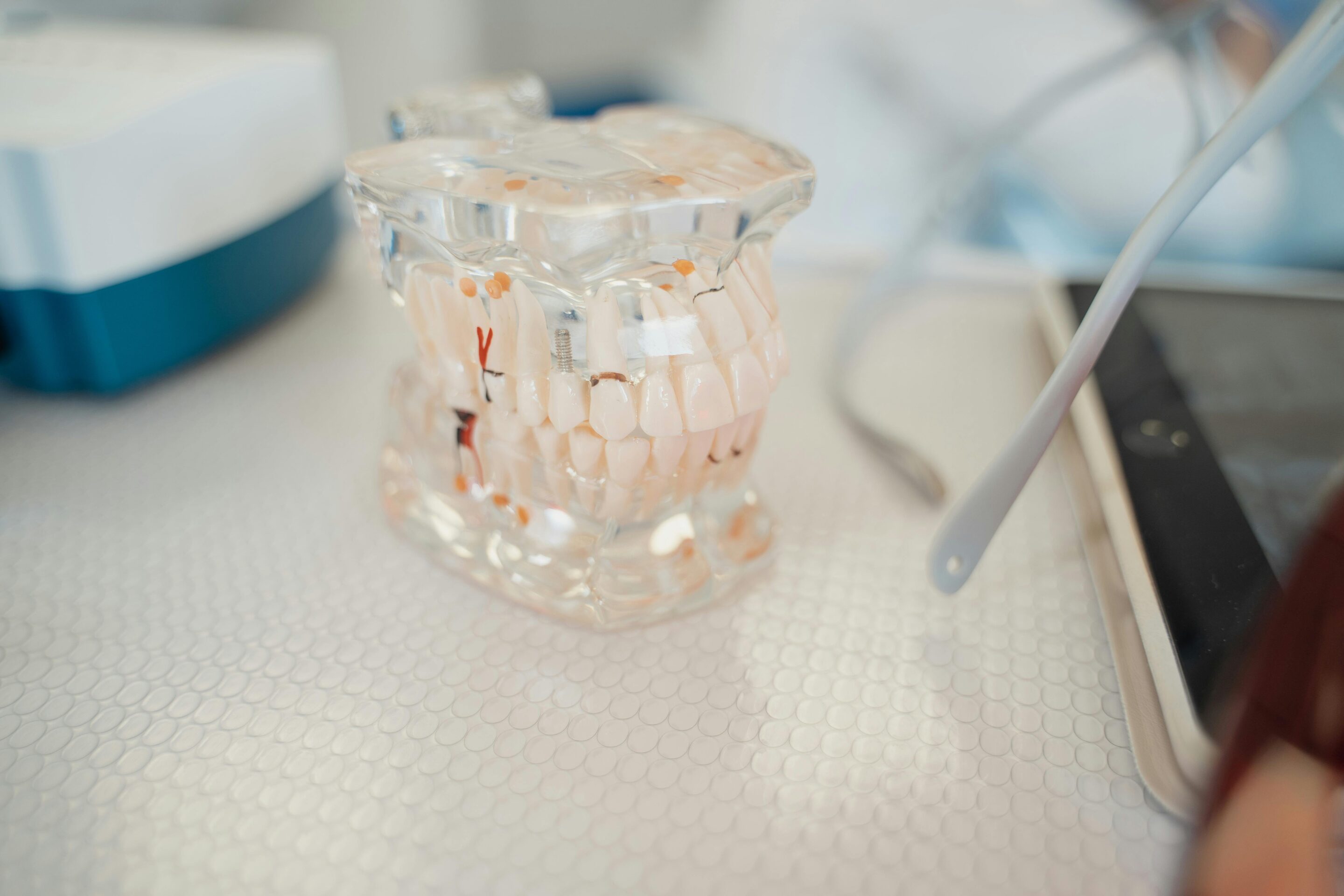 What Is Plaque and How Do You Get Rid of It?