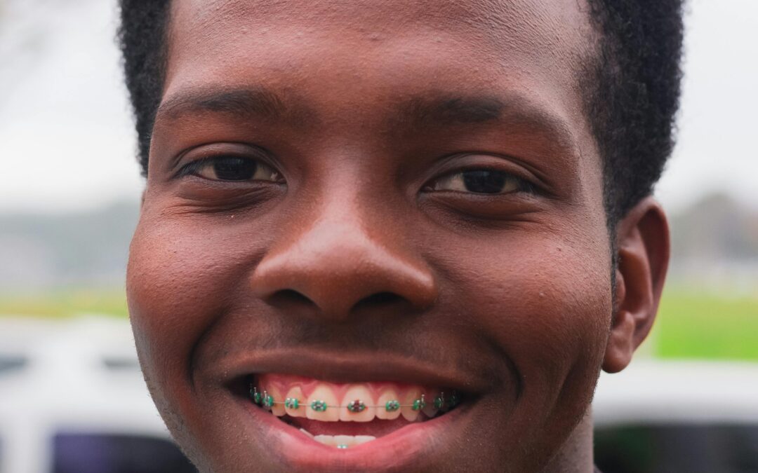 Why Are My Teeth Sensitive to Cold?